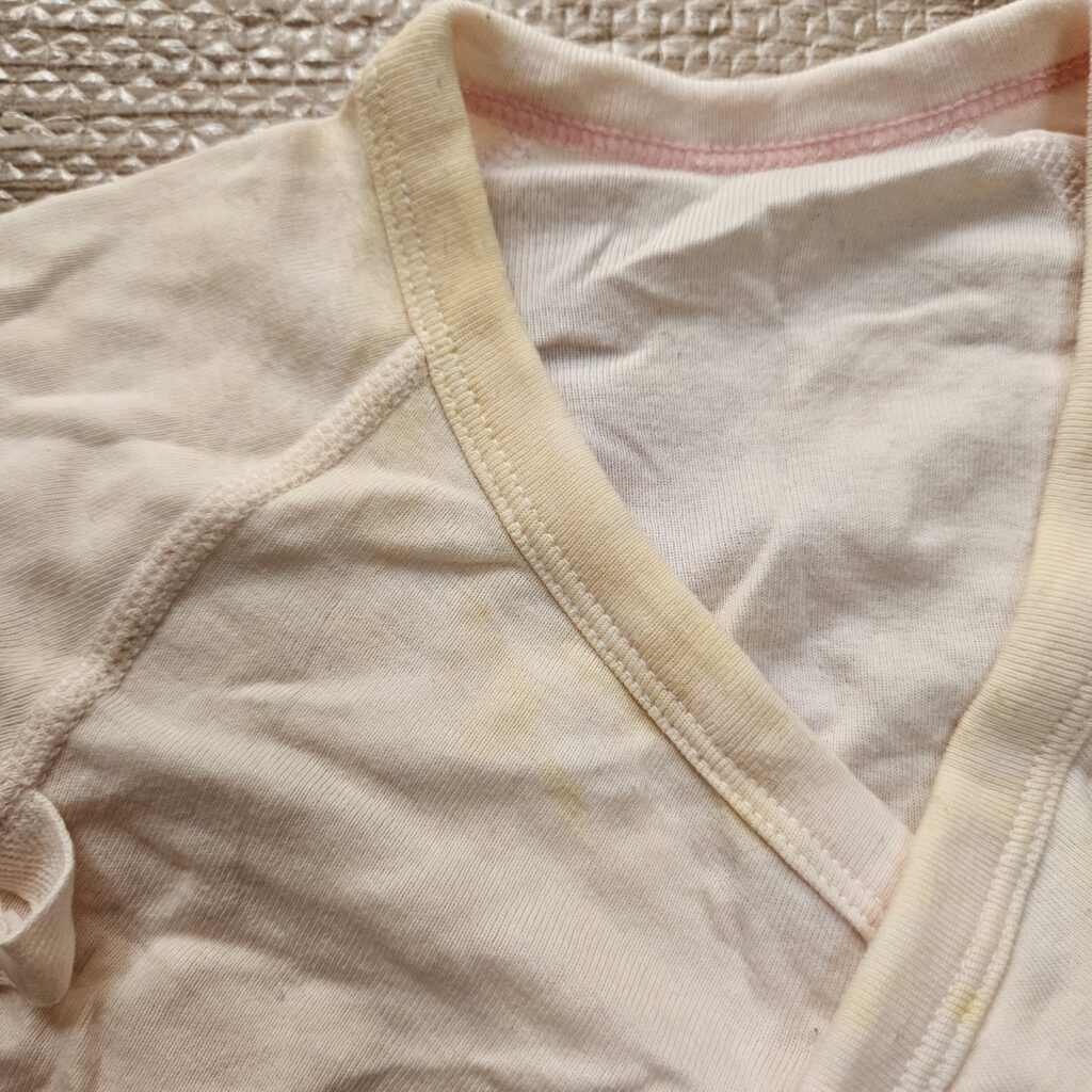 シミのアップの写真